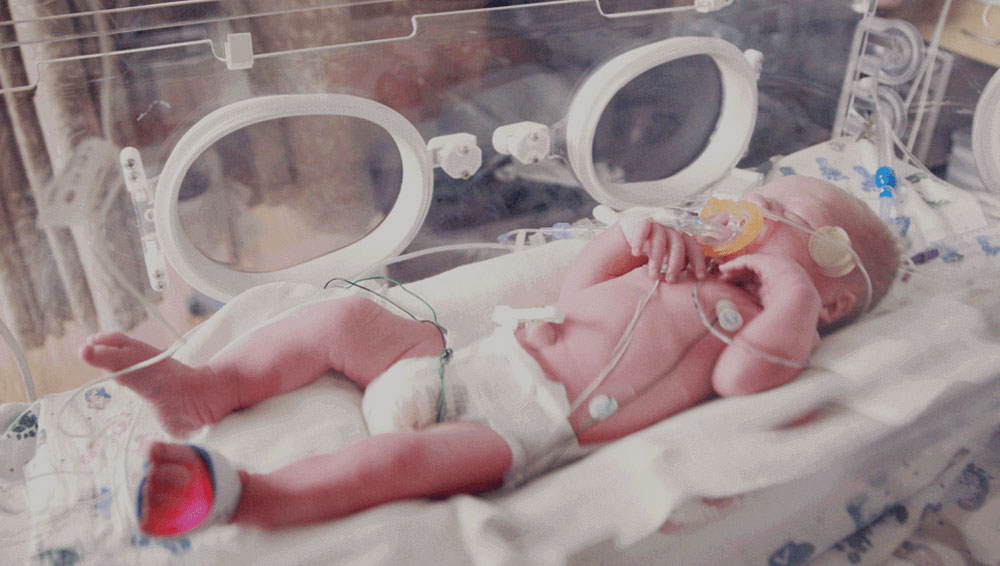 A premature infant in an incubator in the NICU, representing the unique and vulnerable patients who benefit from personalized, data-driven nutrition.