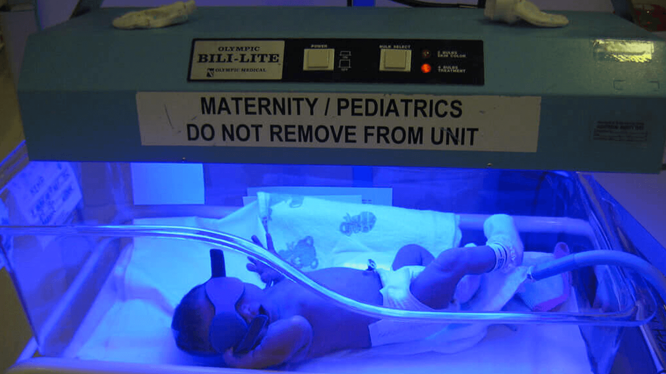 A premature infant receiving care in the NICU, highlighting the critical need for precise, personalized nutrition that standard fortification cannot provide.