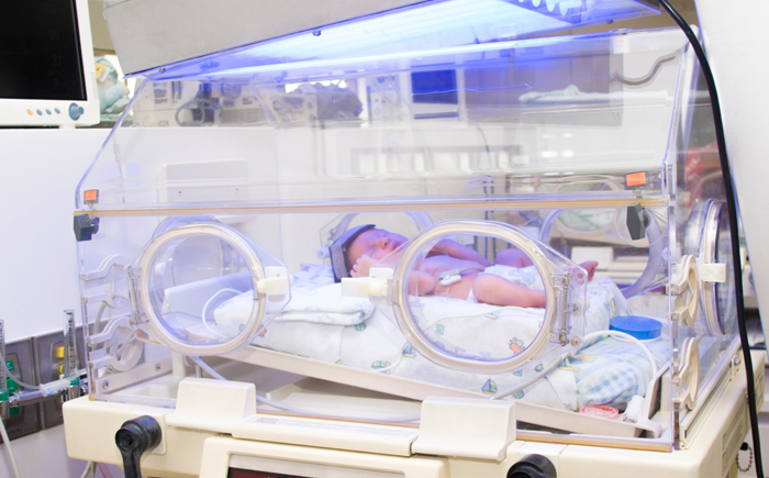 A premature infant receiving specialized care in the NICU, highlighting the vulnerable population that benefits from targeted fortification.