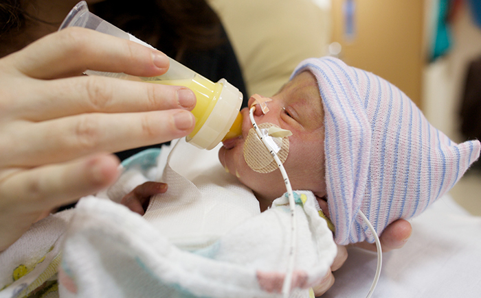 A premature infant being fed via a nasogastric tube, demonstrating the critical role of optimized nutrition in the NICU.