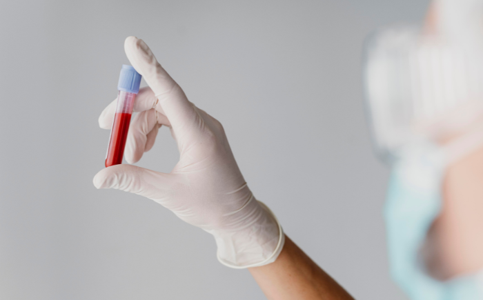 A gloved hand holding a vial of blood for testing, representing the diagnosis and monitoring of anemia in a premature infant.